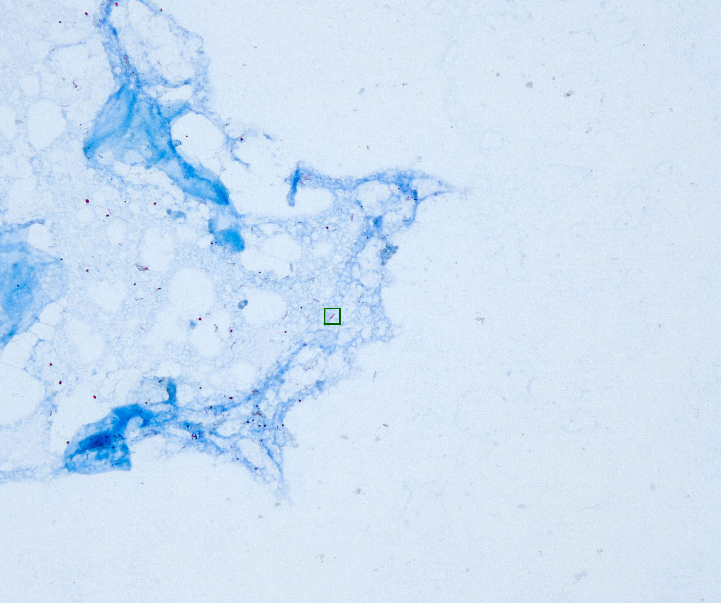 Labeled TB Bacilli